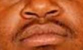 Negroid nose an lips