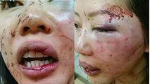 Asian female victim of black brute