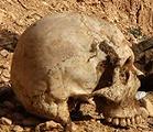 Yazidi skull
