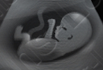 UltrasoundFetus.jpg