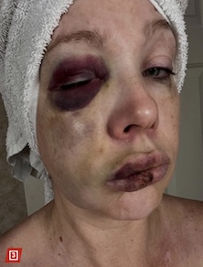 victim